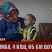 14 Yaşında 4 Kilo Ağırlığında 65 Cm Boyunda