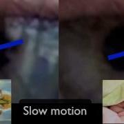 Pupil Dilation Real Life Test Why Pupils Dilate And Pupil Dilation Causes Study