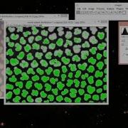 How To Do Image Thresholding In ImageJ