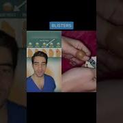 Blister