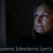 Medical Stories Systemic Scleroderma Lynn S Story