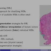 MixUp MIL Novel Data Augmentation For Multiple Instance Learning