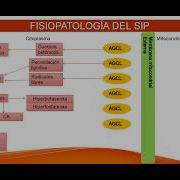 El Lado Oscuro Del Propofol Síndrome De Infusión De Propofol Qué Es Y Cómo Se Previene