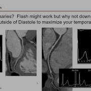 Strategies Used To Improve Cardiac CT Image Quality