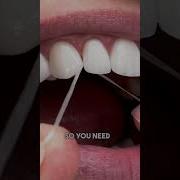 Bleeding Gums Why You Should Keep Flossing