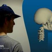 Head Neck 3D Motion Analysis With Inertial Sensors