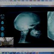 Kinect Effect ER Demo With AS3NUI Library