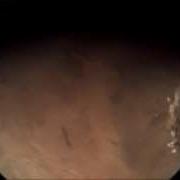 Mars Express Orbiting The Red Planet