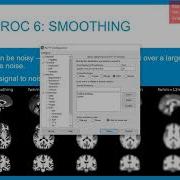 Preprocessing Fmri Data In SPM12