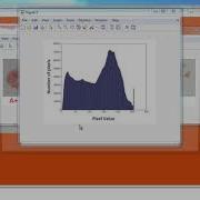 Blood Group Identification Image Processing Matlab Projects
