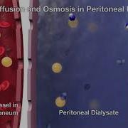 Satellite Healthcare PD Diffusion Osmosis 3D Animation