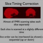 12 FMRI1 Preprocessing Fmri1 E2