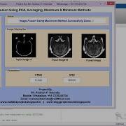 Matlab Code For Image Fusion Using PCA On MRI And CT Image