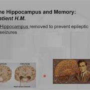 Chapter 12 Learning And Memory Using HM To Learn About Our Memory