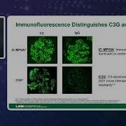 Navigating C3G In Transplantation Addressing Unmet Needs And Managing Recurrence