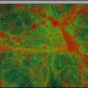 Filamentary Structures Of Gadget 2 Data