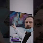 Cracked Tooth Into 2 Parts Broken Tooth Dentist Teeth Dental Dentistry Veneers Caries Decay
