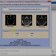 Medical Image Fusion Using Matlab Code