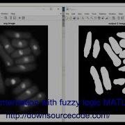 Image Segmentation With Fuzzy Logic MATLAB Code