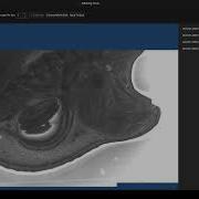 Creating Custom Montage Of Microscope Images Map Stitch