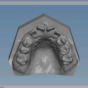 Dental Study Model By OrthoSelect