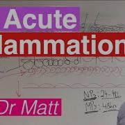 Acute Inflammation Immunology