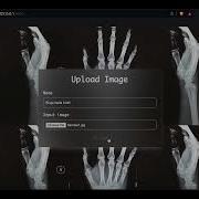 Bone Fracture Detection Web Application