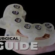 Implant Surgical Guide