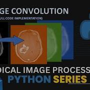 3d RGB Image Convolution In Python Code Implementation Biomedical Image Processing 3d Array