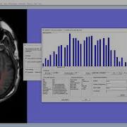FireVoxel Radiomics Features 2D Basic Operation