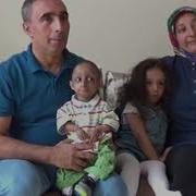 Görüntülü 14 Yaşındaki İlker 4 Kilo Ağırlığında 65 Santimetre Boyunda