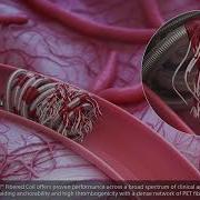 EMBOLD Detachable Coil System Embolization Procedure Animation