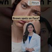 What Are Freckles Brown Spots On Face Freckles Frecklestreatment