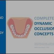 Complete Denture Dynamic Occlusion Concepts