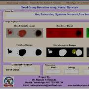 Blood Group Detection Using Neural Network Matlab Project Code Blood Group Prediction Using Matlab