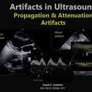 Artifacts In Ultrasound 6 Propagation Attenuation Artifacts