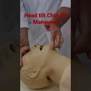 Head Tilt Chin Lift Maneuver Medtimewithdrmuneerjan