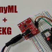 TinyML Tutorial Detecting Arrhythmias With AD8232 And TensorFlow Lite On Arduino Nano 33 BLE
