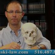 Failure To Diagnose Subdural Hematoma In NY Medical Malpractice Trial Lawyer Gerry Oginski Explains