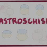 Gastroschisis Causes Symptoms Diagnosis Treatment Pathology