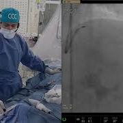 CCC Live Relay CSIRAJCON 2025 High Risk LM And Bifurcation PCI