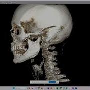 CBCT Toolkit Realtime Demonstration