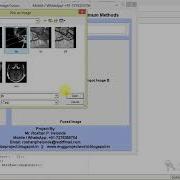 Image Fusion Using Matlab Code