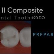 Class II Composite Preparation Acadental Tooth 20 DO