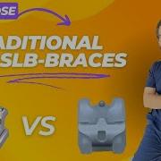 Choosing Your Braces Classical Vs Self Ligating