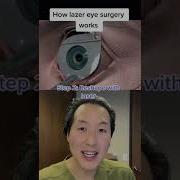 Как работает лазерная коррекция зрения LASIK Shorts Lasik Lasereyesurgery