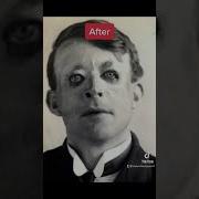 World War Soldiers Before And After Shorts