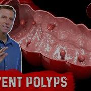 What Is A Polyp The Best Food For Colon Polyp Prevention Dr Berg