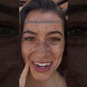 Freckles Before And After The Sun Hits Freckles Skincare Skincareroutine
