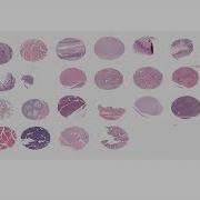 Tissue Array